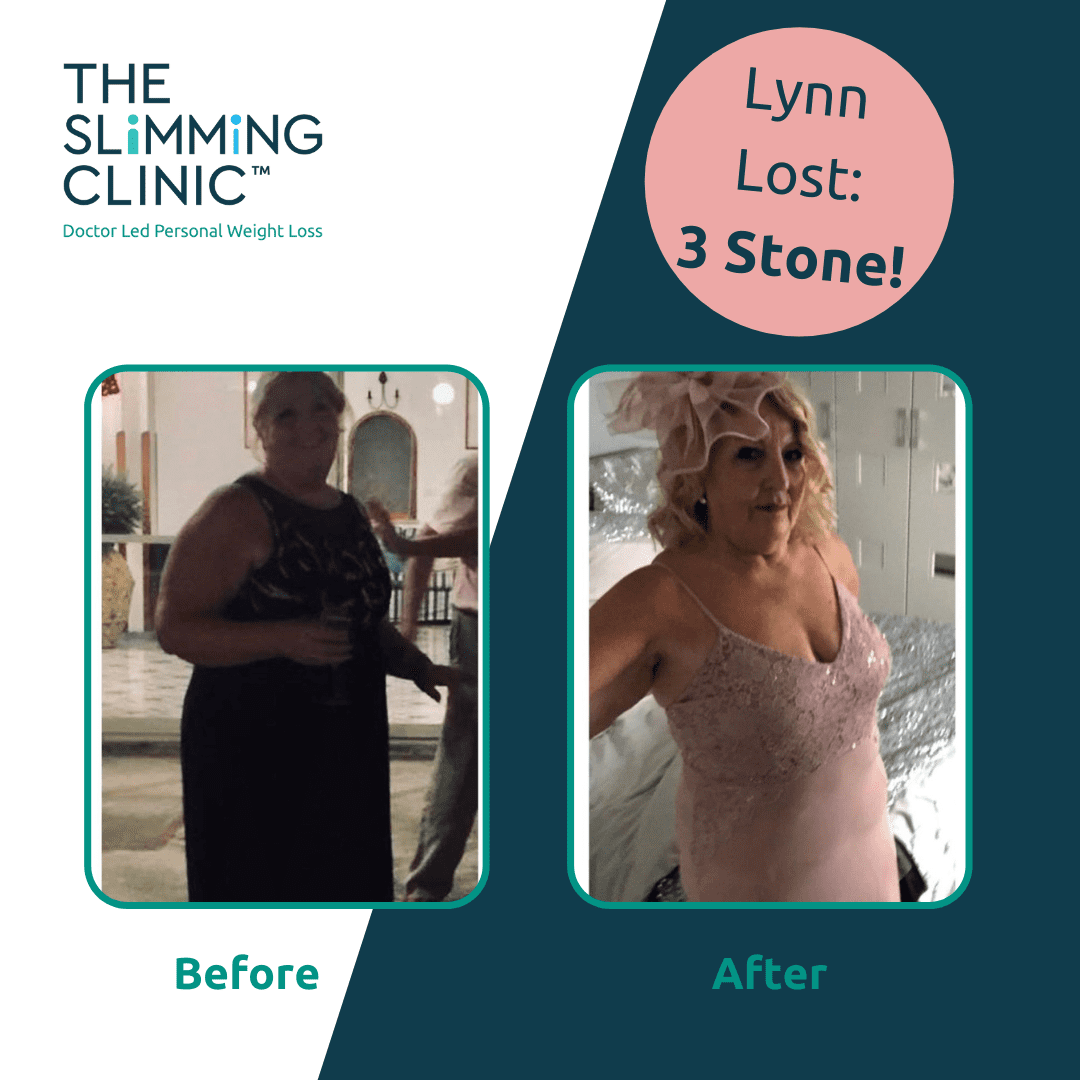 Lynn’s Weight Loss Story